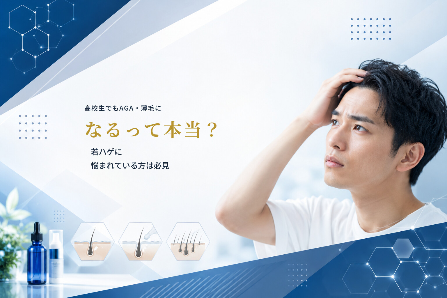 高校生でもAGA・薄毛になるって本当？若ハゲに悩まれている方は必見