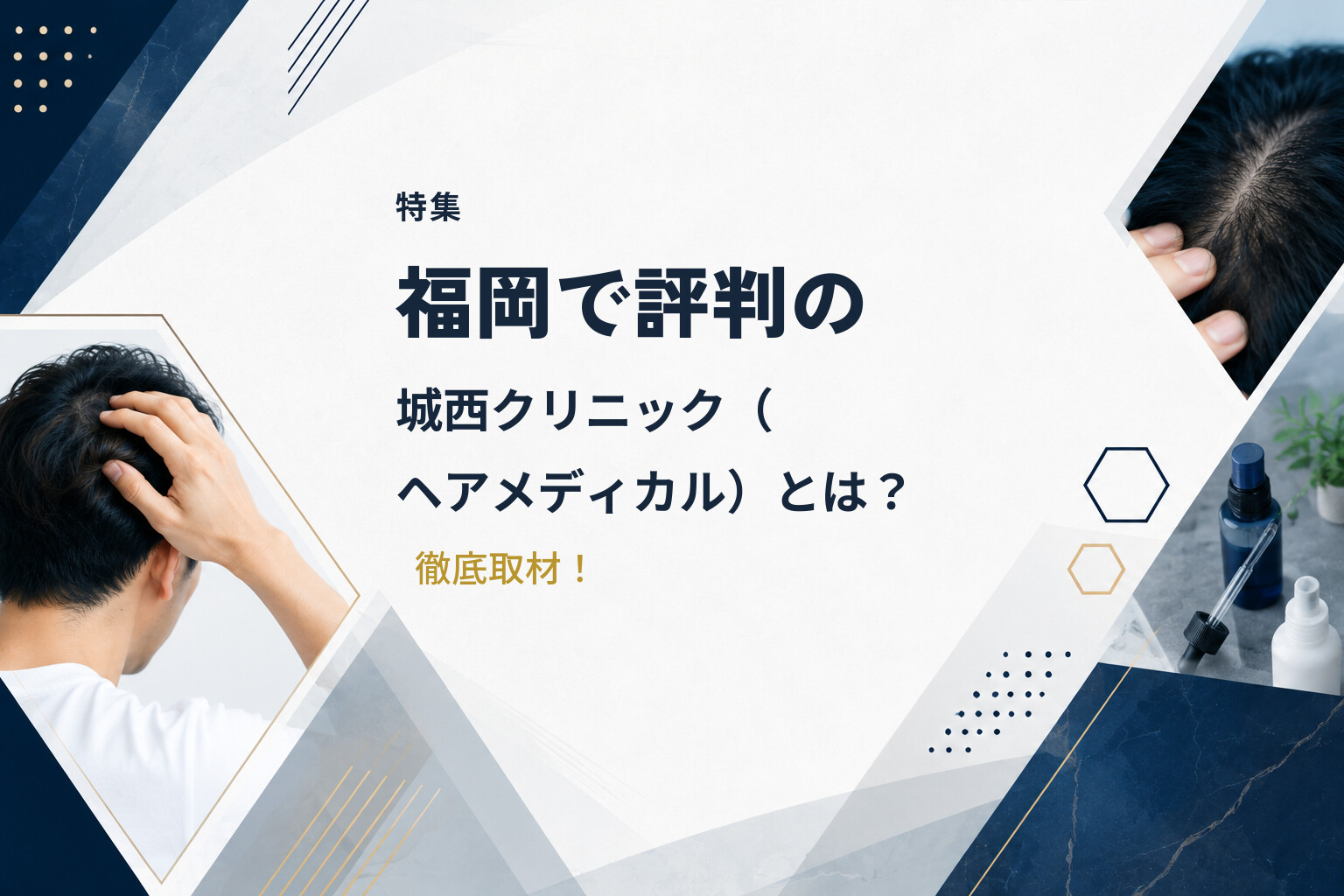 【特集】福岡で評判の城西クリニック（ヘアメディカル）とは？徹底取材！