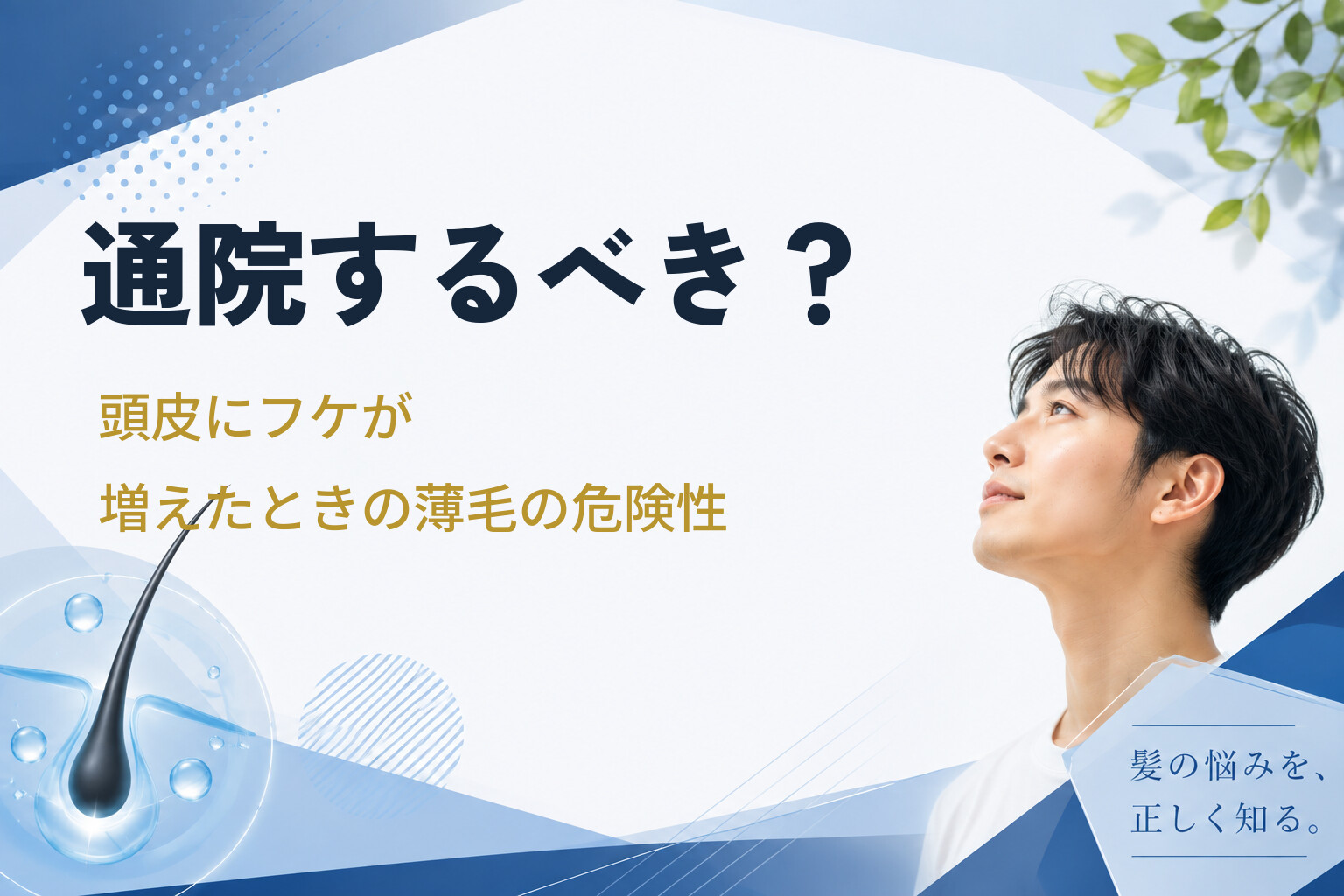通院するべき？頭皮にフケが増えたときの薄毛の危険性