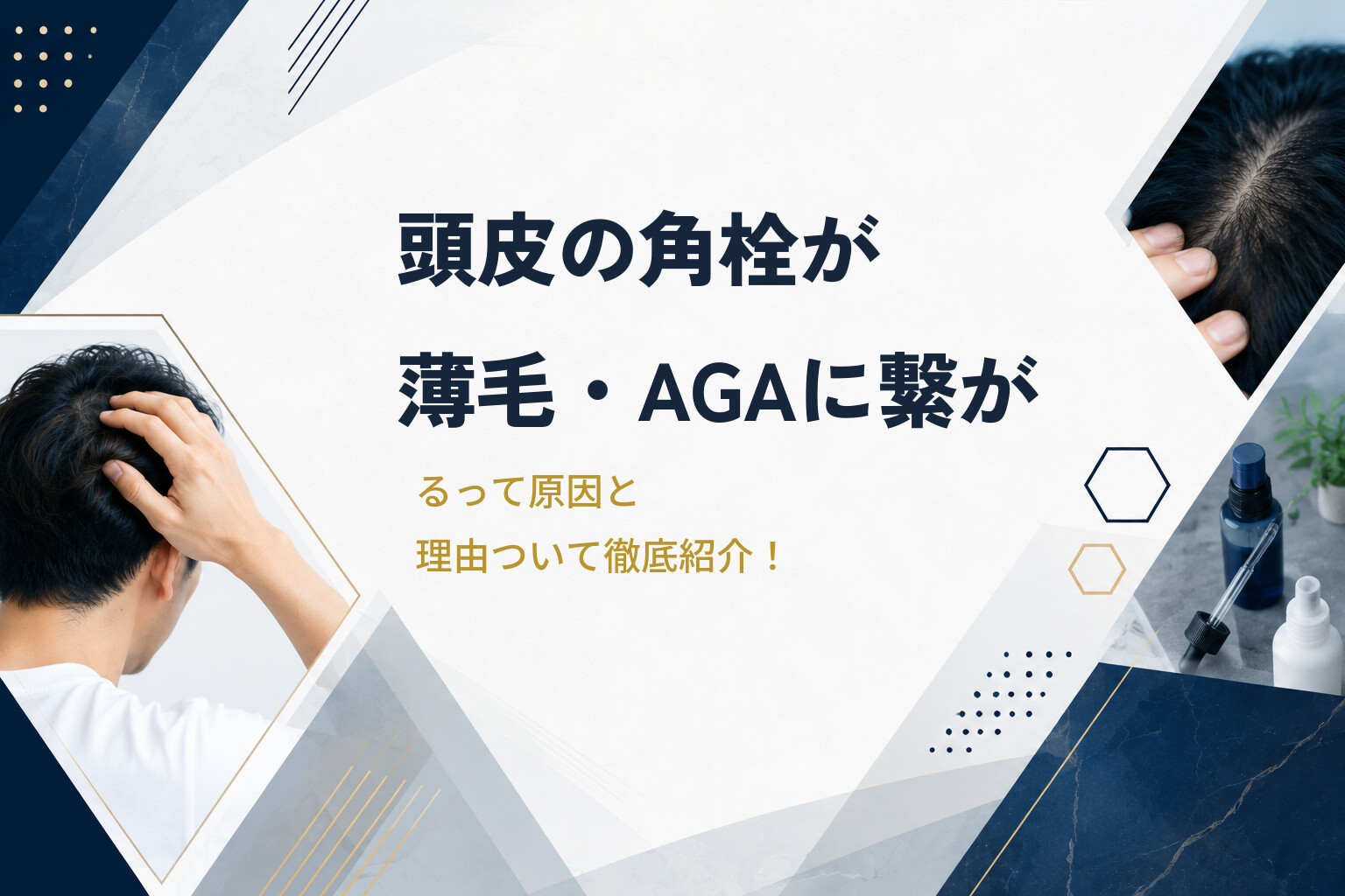 頭皮の角栓が薄毛・AGAに繋がるって原因と理由ついて徹底紹介！