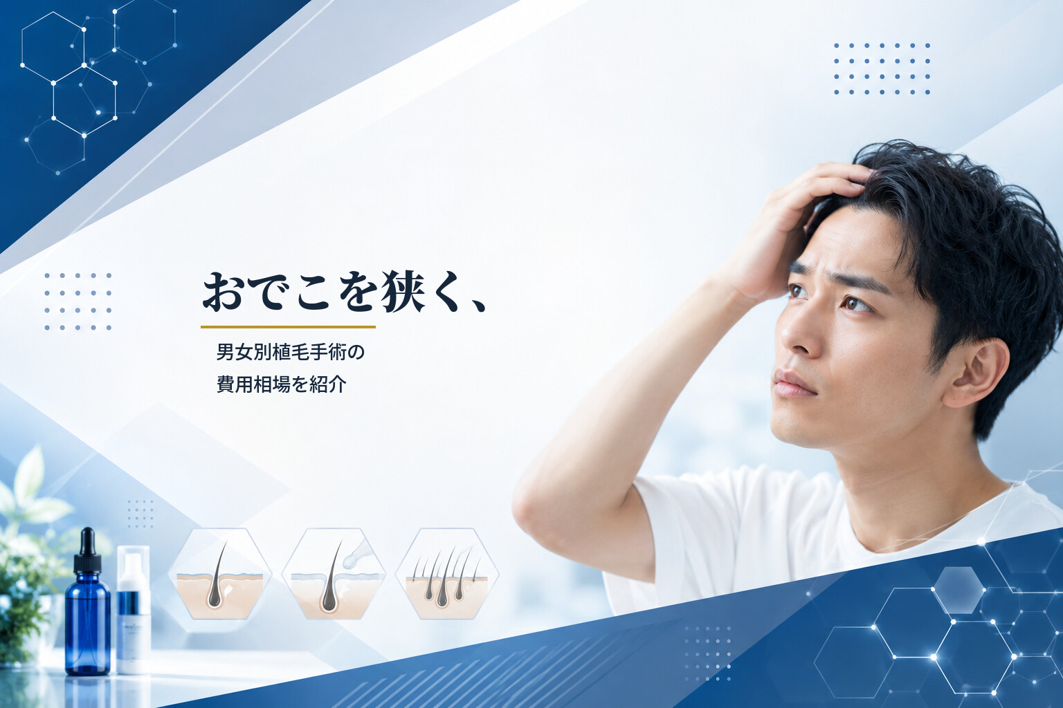 おでこを狭く、男女別植毛手術の費用相場を紹介