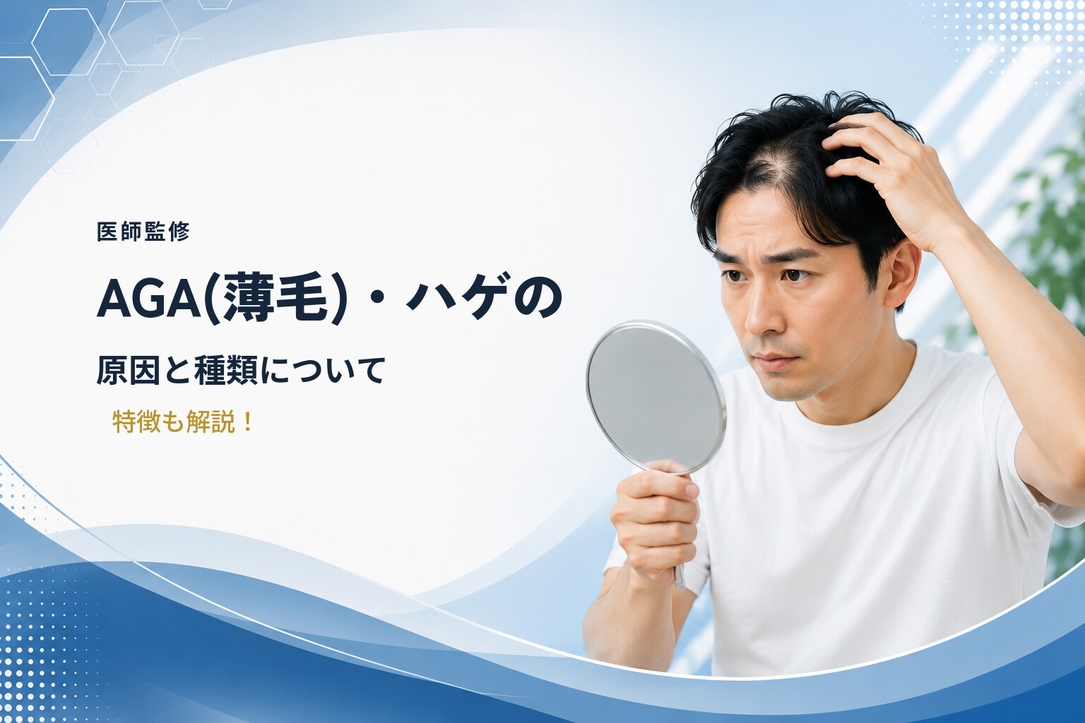【医師監修】AGA(薄毛)・ハゲの原因と種類について｜特徴も解説！