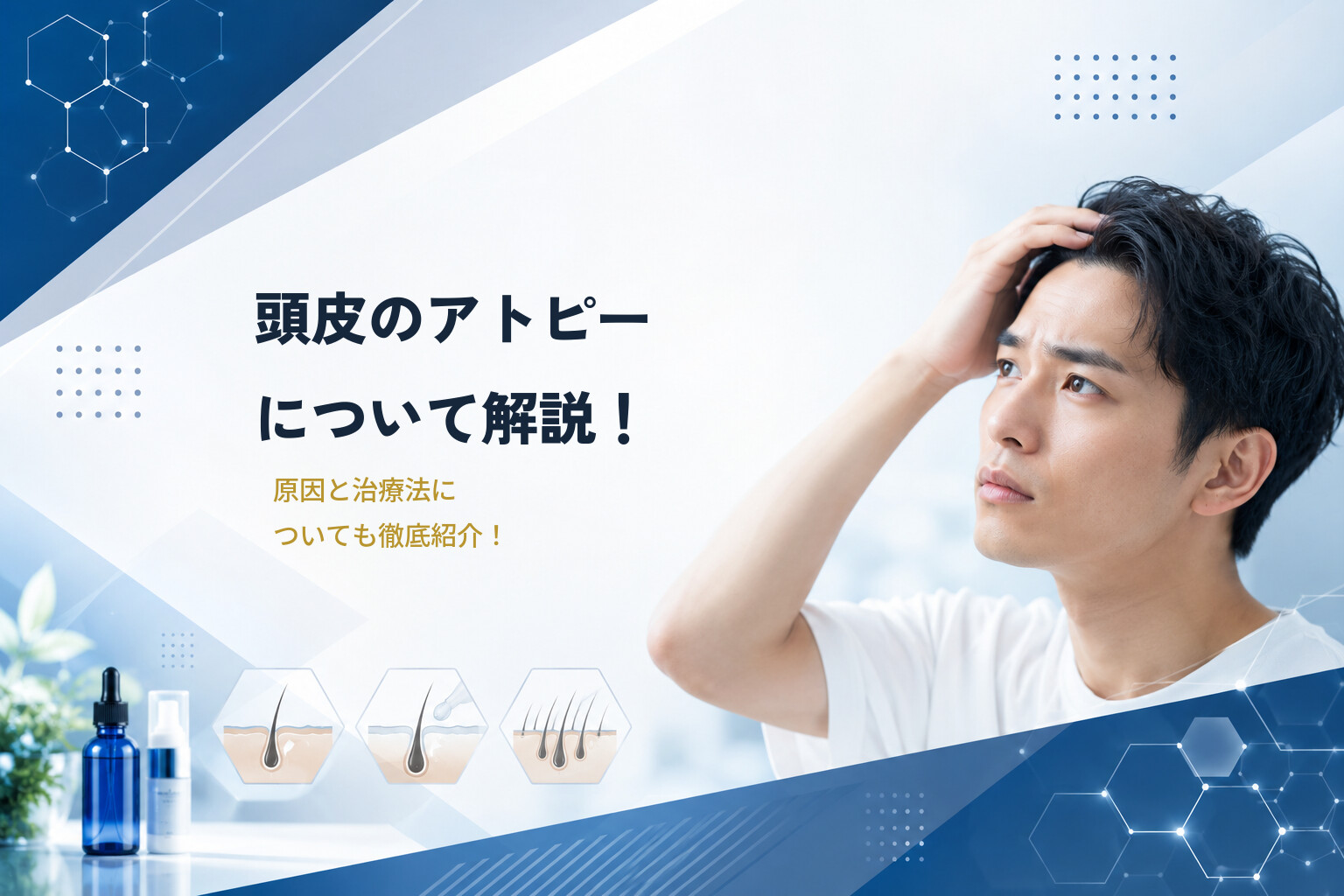 頭皮のアトピーについて解説！原因と治療法についても徹底紹介！
