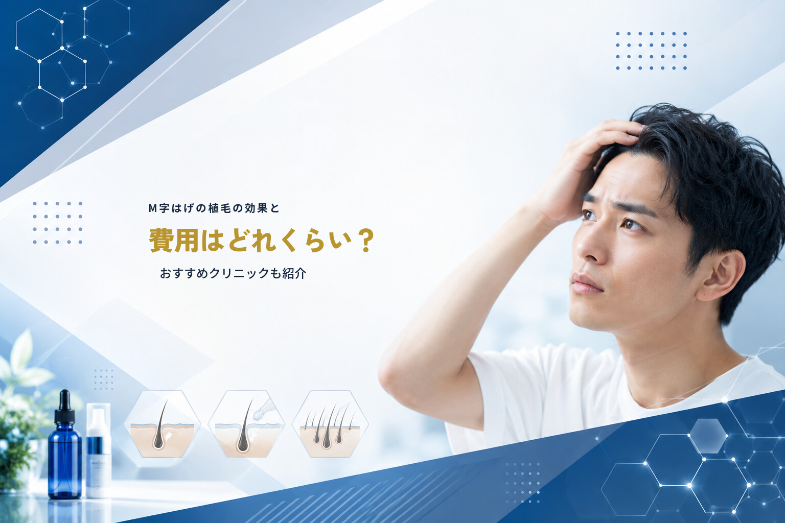 M字はげの植毛の効果と費用はどれくらい？おすすめクリニックも紹介