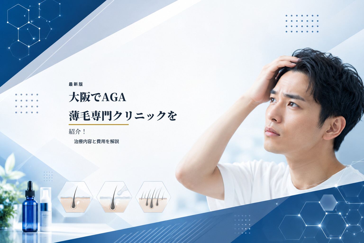 【最新版】大阪でAGA薄毛専門クリニックを紹介！治療内容と費用を解説
