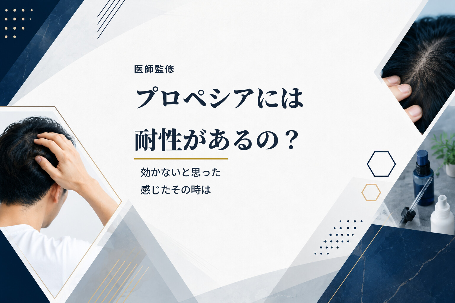 【医師監修】プロペシアには耐性があるの？効かないと思った感じたその時は