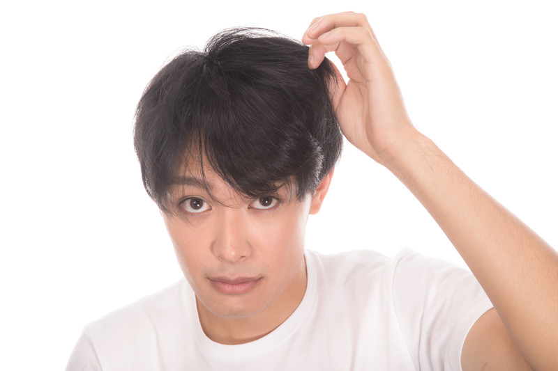 【医師監修】AGA(薄毛)・ハゲの原因と種類について｜特徴も解説！