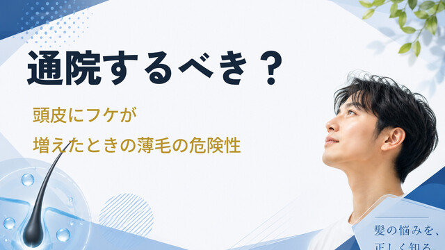 通院するべき？頭皮にフケが増えたときの薄毛の危険性