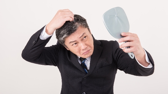つむじはげ｜つむじが薄い人は○○がある？？